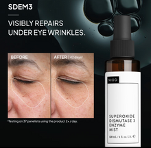 NIOD Superoxide Dismutase 3 Enzyme Mist (SDEM3)